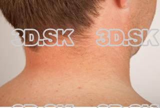 Neck texture of Omar 0005